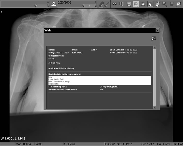 Figure 2. View from PACS Display