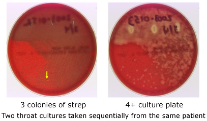 Figure example of sampling error in throat cultures