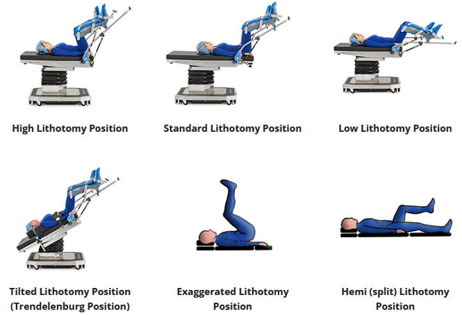 Figure 1. Lithotomy Position Variations